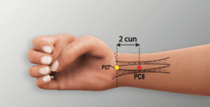 pc6 acupressure